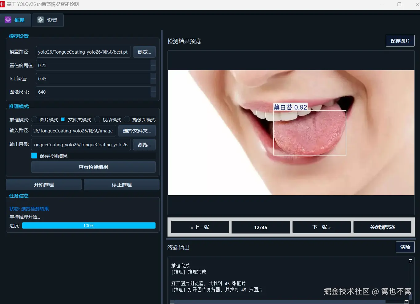（此处展示舌苔检测的实际效果图片，包括各类舌苔的检测结果展示）