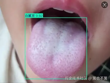 image-20250801140634617