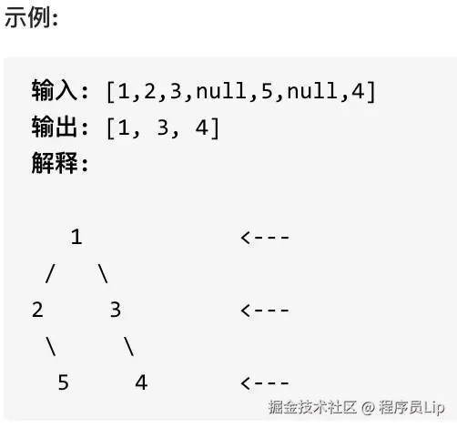 199.二叉树的右视图