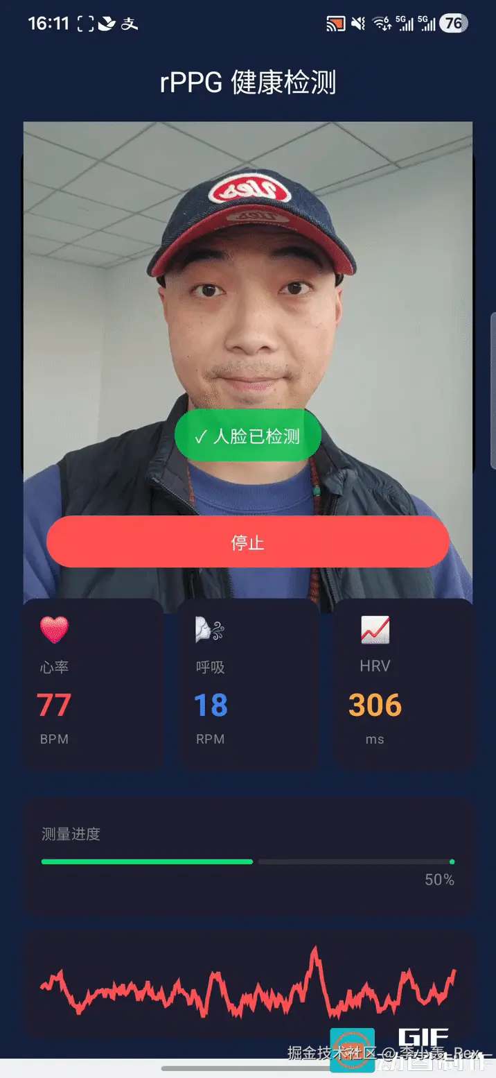 rppg.gif