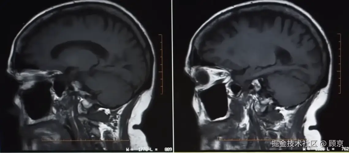 核磁共振成像结果.png