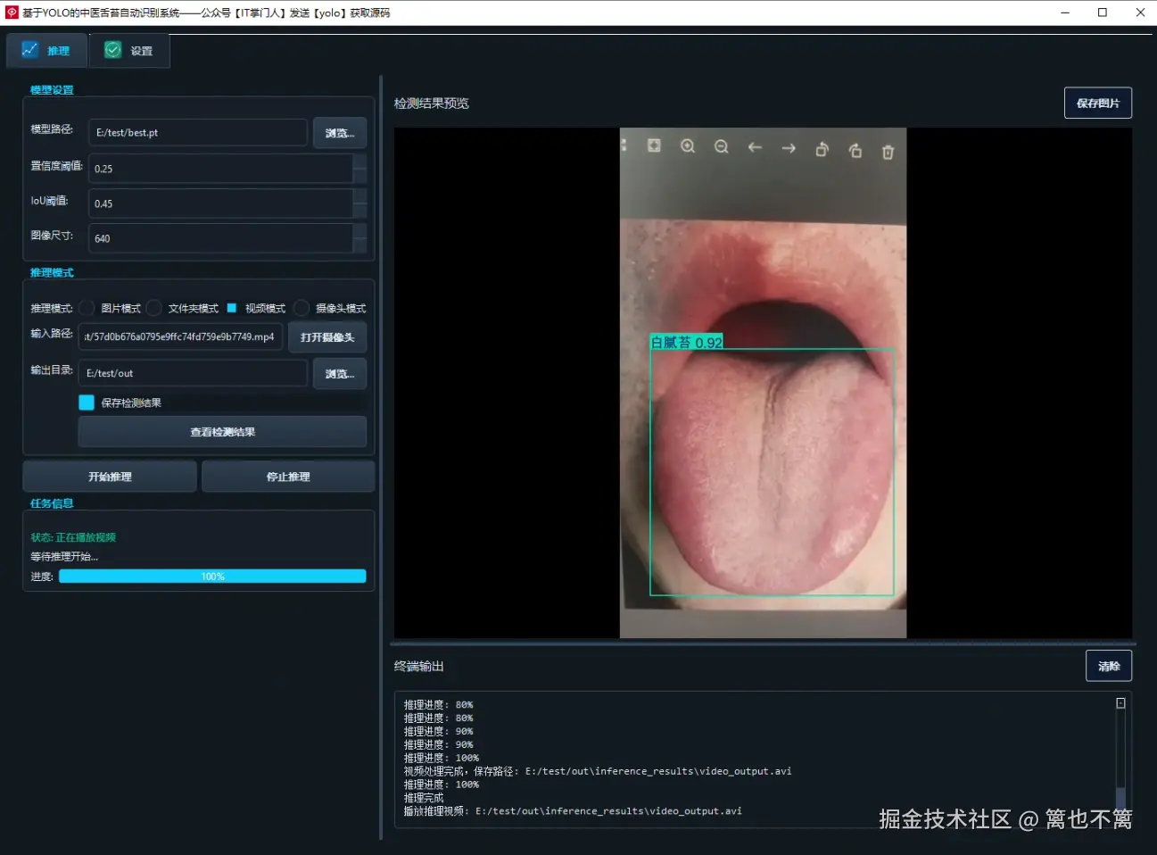 image-20250801140832217