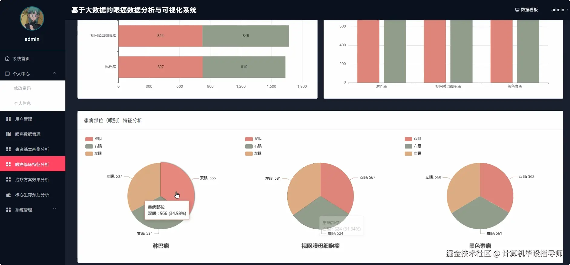 眼癌临床特征分析.png