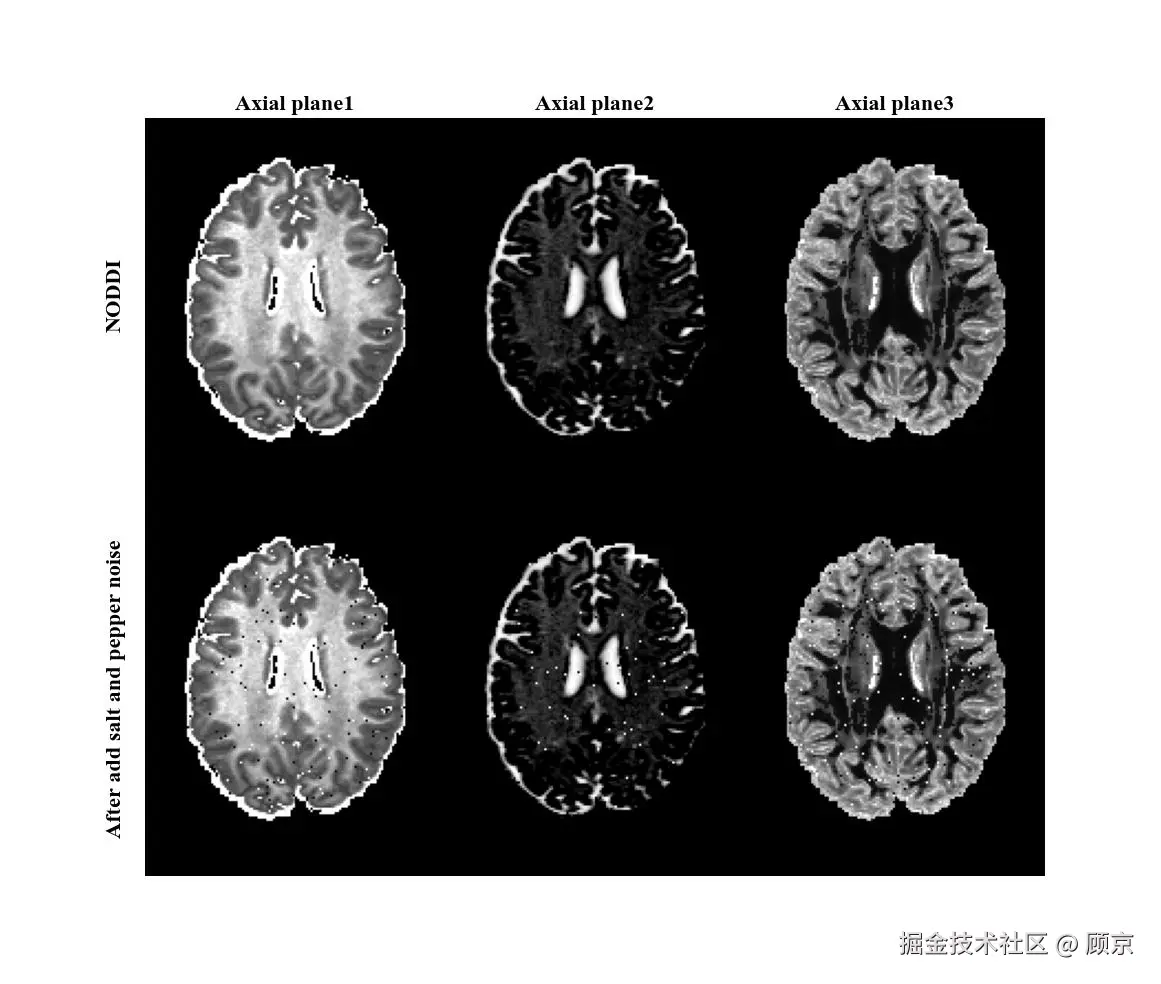 add salt and pepper noise.jpeg